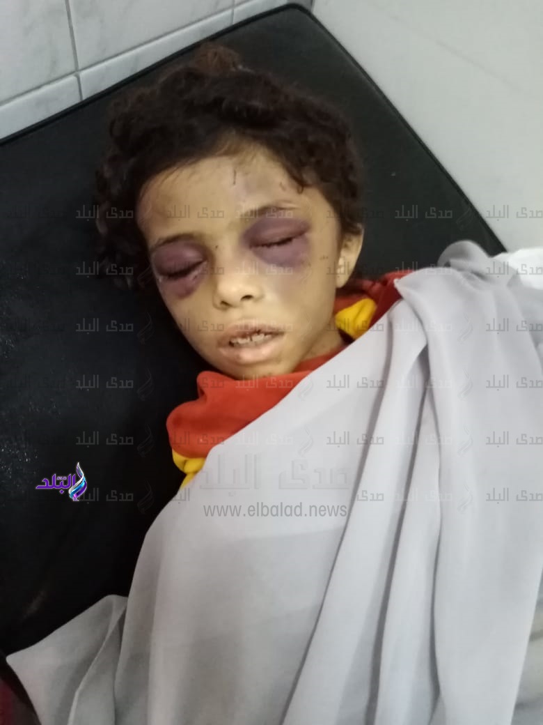 الطفلة المعتدي عليها الطفلة المعتدي عليها