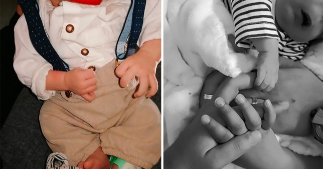 الطفل البرتغالي المولود بلا وجه