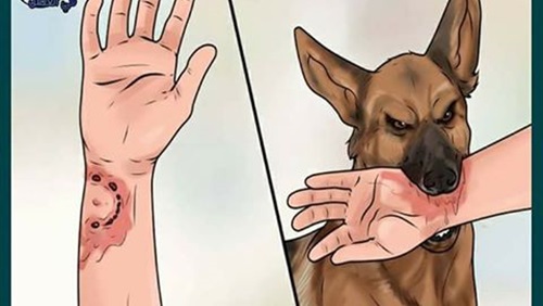 تعرف على الخطوات الصحيحة لعلاج عضة الكلب تعرف على الخطوات الصحيحة لعلاج عضة الكلب
