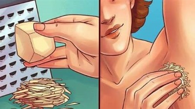 مناطق داكنه