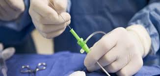  الإفتاء توضح حكم صلاة مريض يركب قسطرة البول