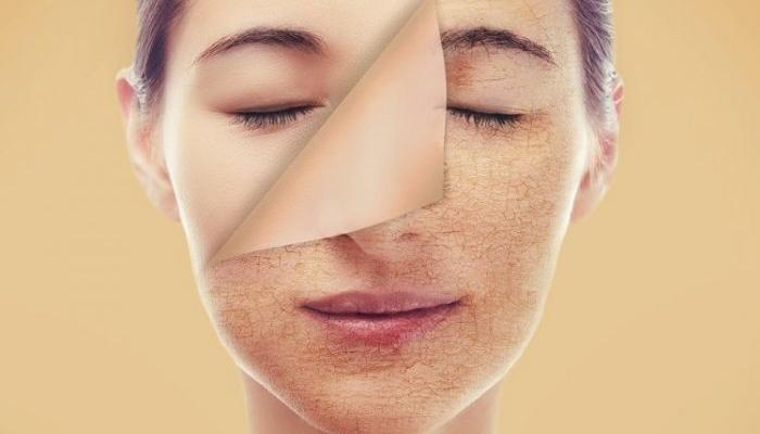 6 نصائح فعالة للعناية بالبشرة الجافة في الشتاء