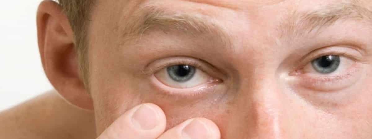 عينيك بترف باستمرار؟ أسباب شائعة لا تتجاهليها 