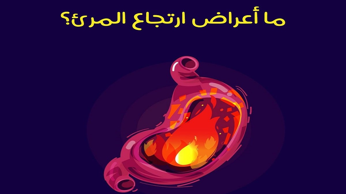 ارتجاع المريء