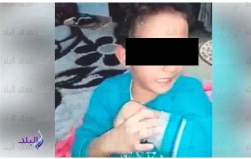 طفل تعدت عليه الأم بالضرب