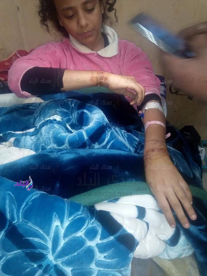 الطفلة ضحية التعذيب الطفلة ضحية التعذيب