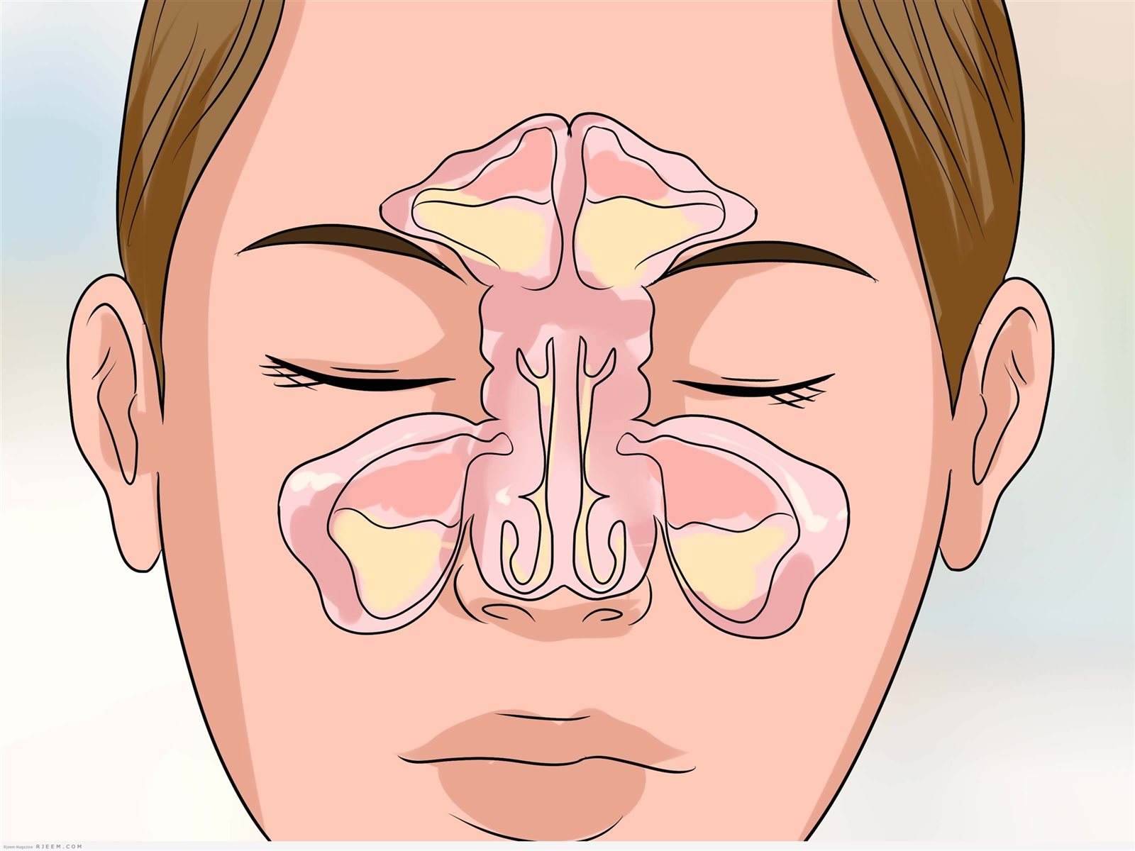 الجيوب الأنفية مبهدالك في الشتا .. اكتشف اهم اسباب انتشارها 