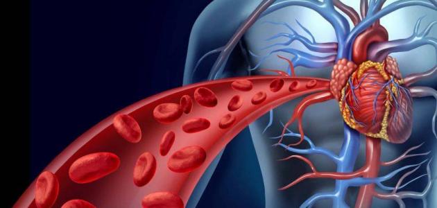 تصلب الشرايين