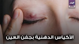 اكياس دهنية