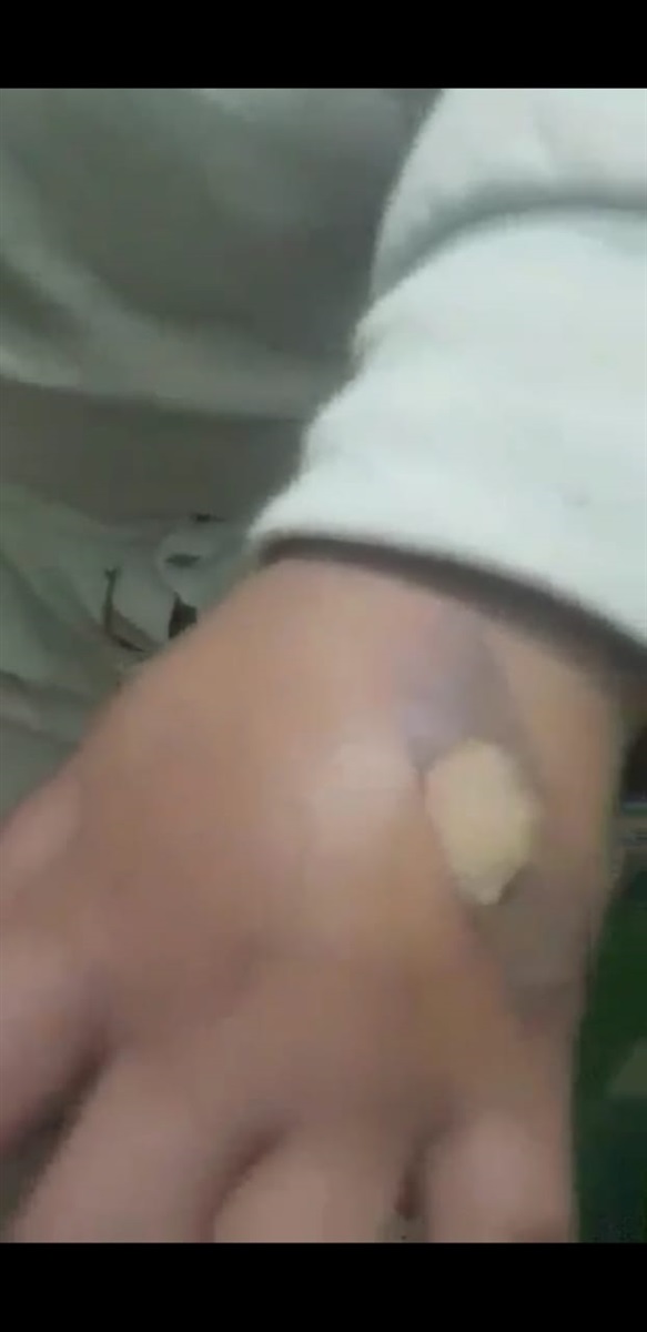 طفلة المجنى عليها