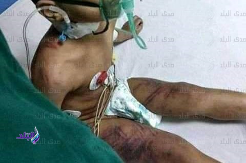 حقيقة تعذيب طفل