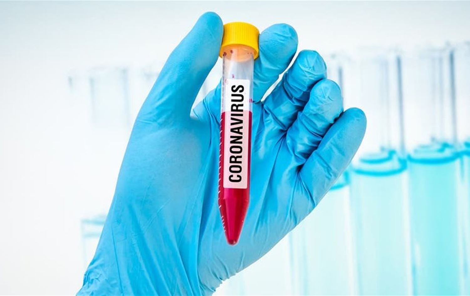 خريطة انتشار كورونا فى الدول العربية والعالم