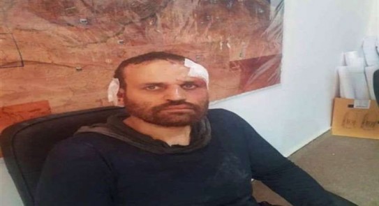 هشام عشماوي 