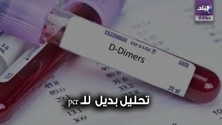 تحليل كورونا
