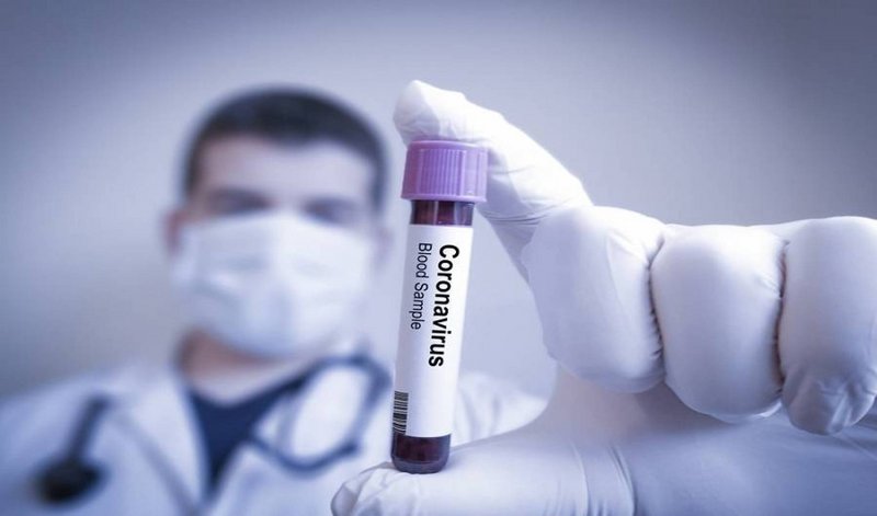 هولندا تحظر التجمعات بسبب فيروس كورونا