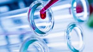 روسيا تختبر علاجات لت كورونا