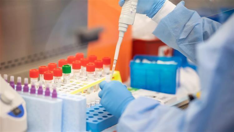 الكويت تزف بشري سارة عن حالات كورونا