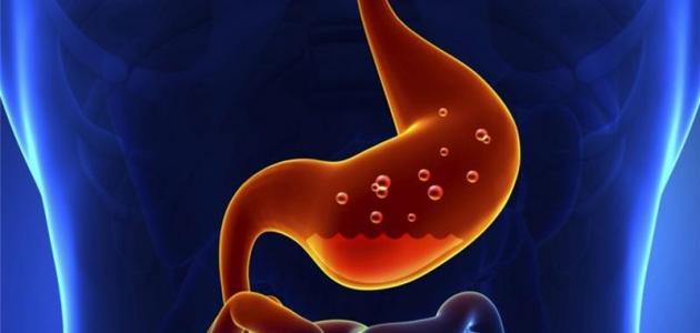 التهاب المعدة