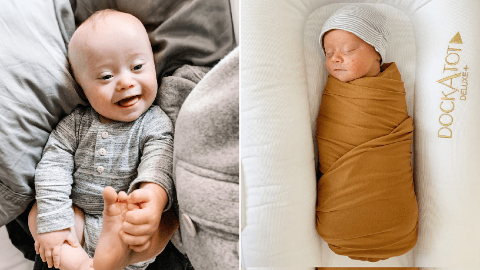 طفل متلازمة داون موديل إعلانات