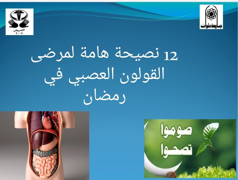جامعة حلوان 