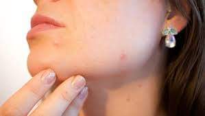 ماسك للبشرة