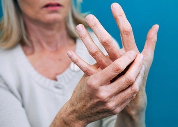 مرضى الروماتزم 