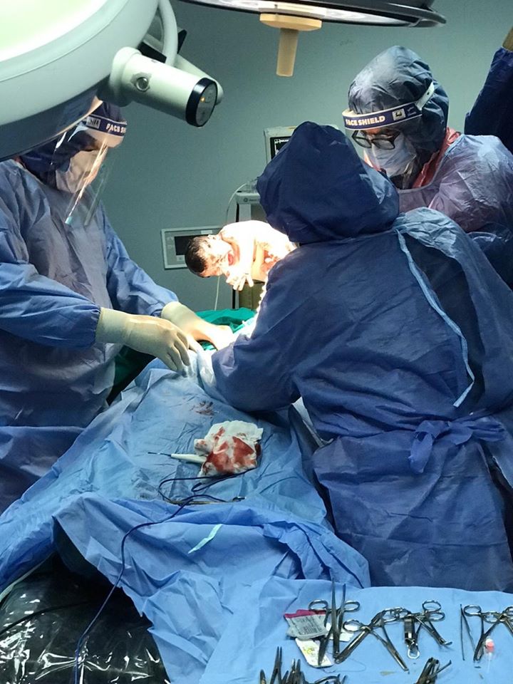 اول ولاد قيصرية لام مصابة بكورونا بدمياط