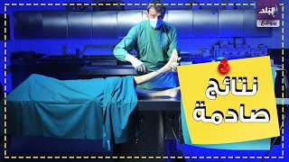 تشريح جثث مصابي كورونا