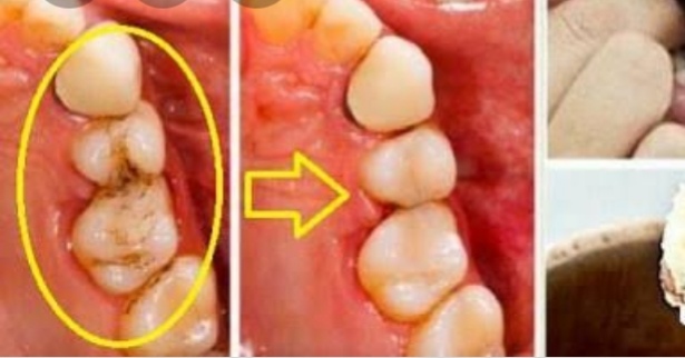 بدون مسكنات... حيله عجيبة ترفع المناعة وتسكن آلام الأسنان