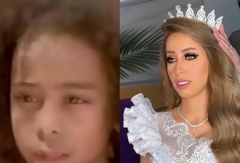 بعد مرور 15 عاما.. شاهد شكل الطفلة سوكا في حفل زفافها