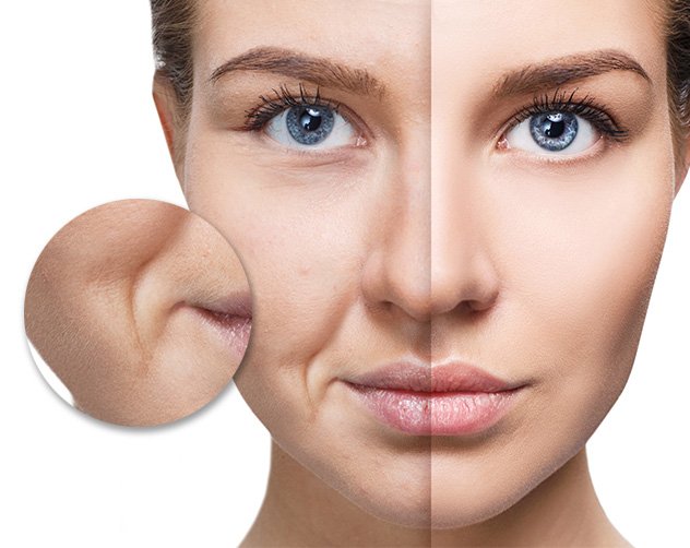 تعرف على طريقة استخدام خيوط شد الوجه وشروطها