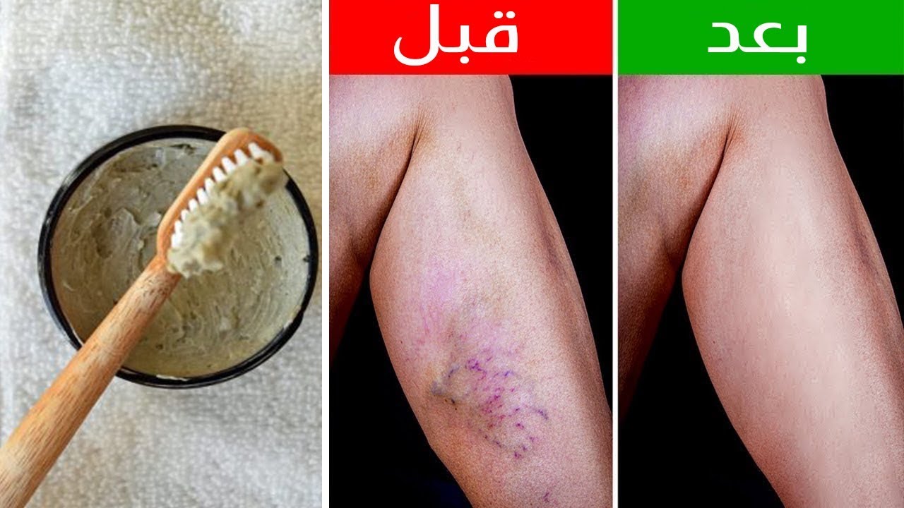 دوالى