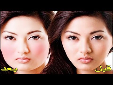 وصفة تسمين الخدود 