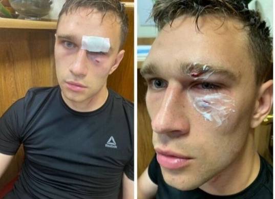 اعتداء على حكم بدوري الهواة الروسي