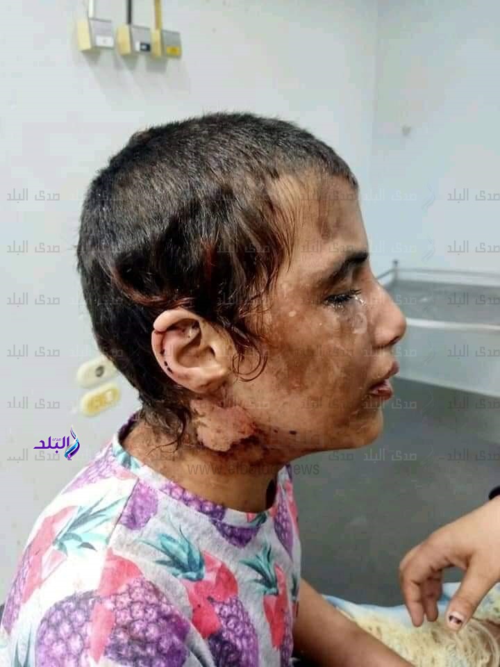 الطفلة المجنى عليها 