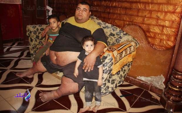 محمود المصاب بالسمنه 