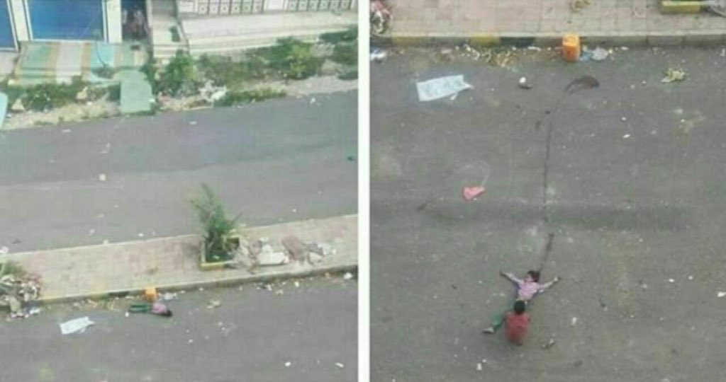 الطفلة اليمنية التي قنصتها ميليشيات الحوثي