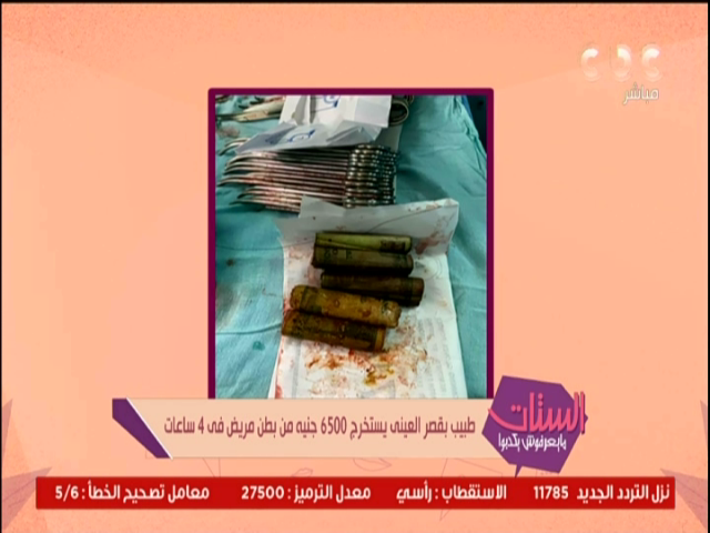 إستخراج 6500 جنيه من بطن مريض فى 4 ساعات من خلال طبيب بالقصر