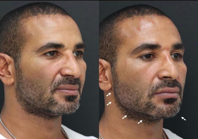 أحمد سعد 