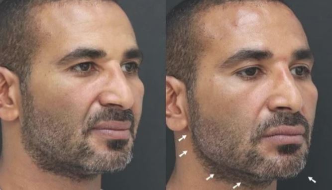 احمد سعد 