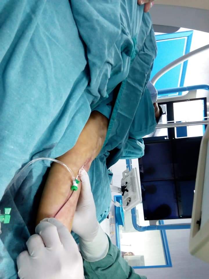 . فريق طبي ينجح بانهاء معاناة مريضة فشل كلوي بمستشفى المنصور