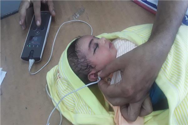 فحص 9186 طفلًا حديث الولادة بالمنيا ضمن مبادرة السمعيات