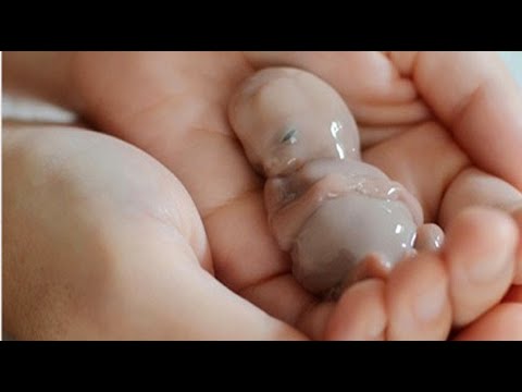 خطر يهدد حياتك اكتشفي مخاطر الإجهاض المنزلي