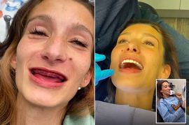 بكاء متعافية من الإدمان بسبب طقم أسنان