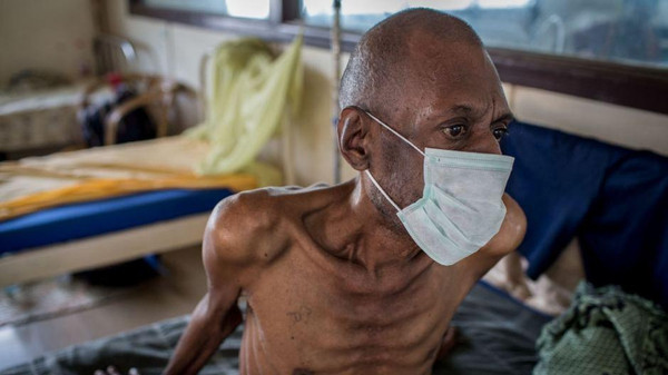 تاريخ مرض السل