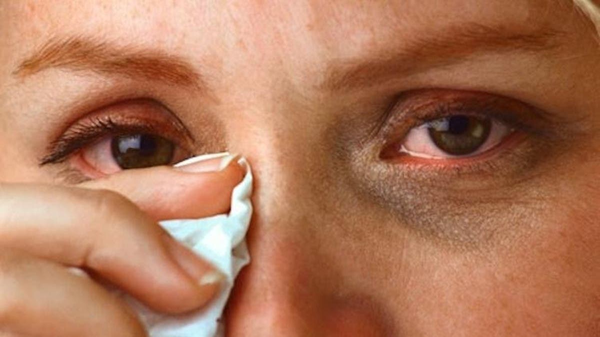 بالمجان علاج حساسية الأنف بالمنزل