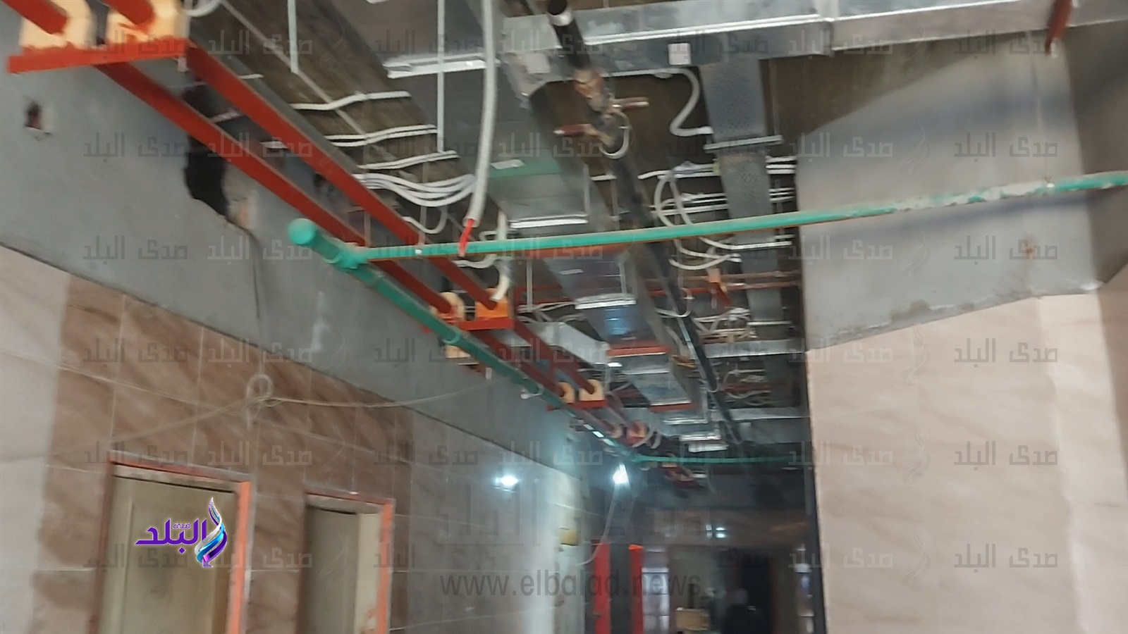 مستشفى للحروق بالقناطر الخيرية