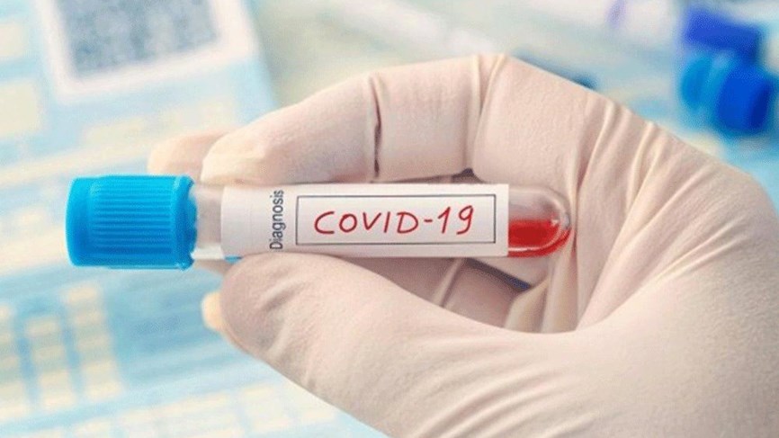 فيروس كورونا