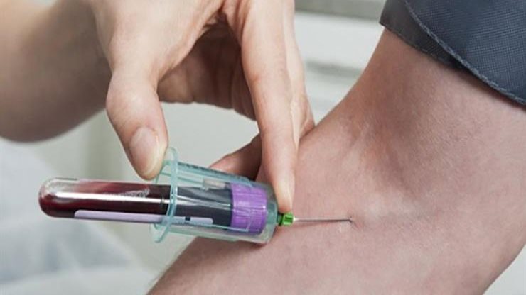 إجراء تحليل المخدرات المفاجيء  إجراء تحليل المخدرات المفاجيء