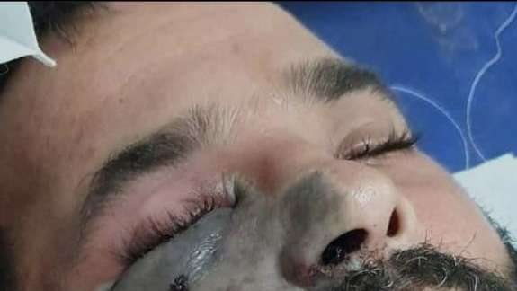 الفطر الاسود